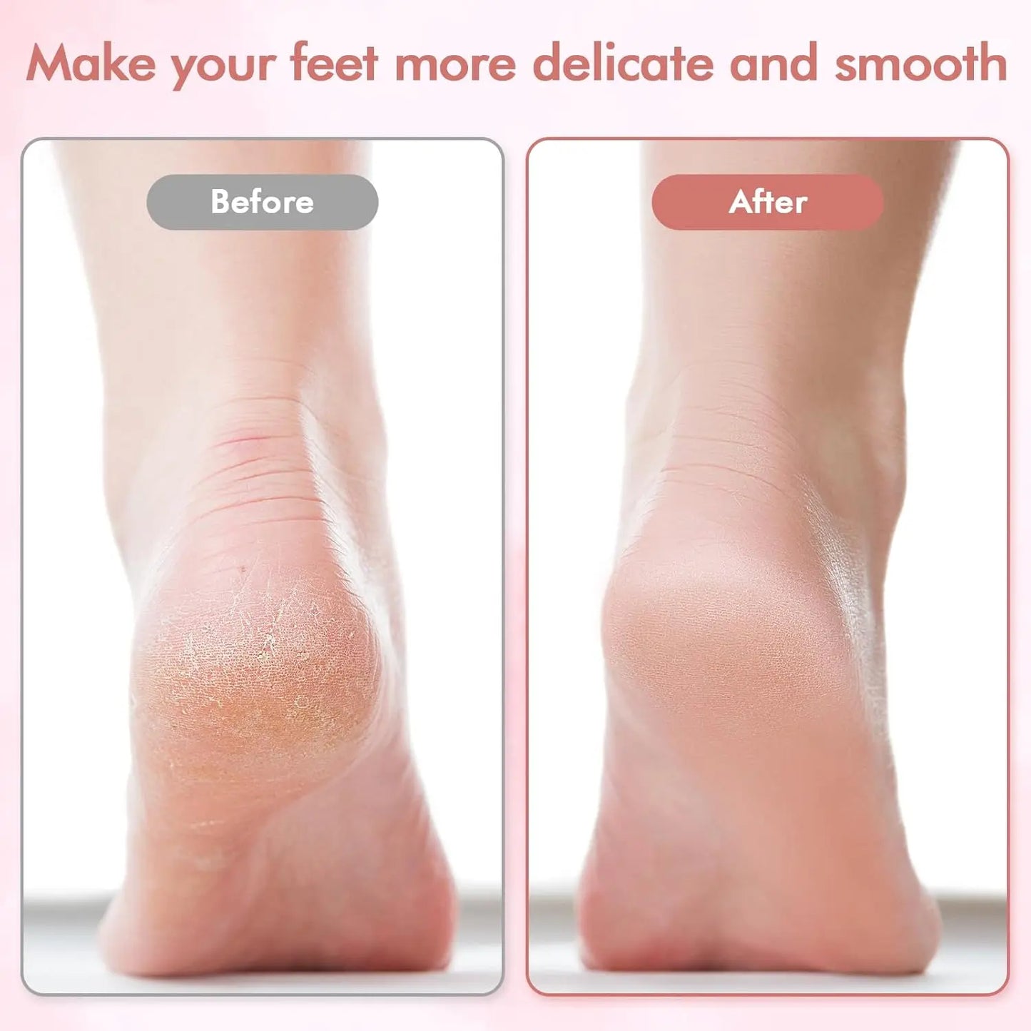 The #1 Electric Foot File for Salon-Smooth Feet in Minutes