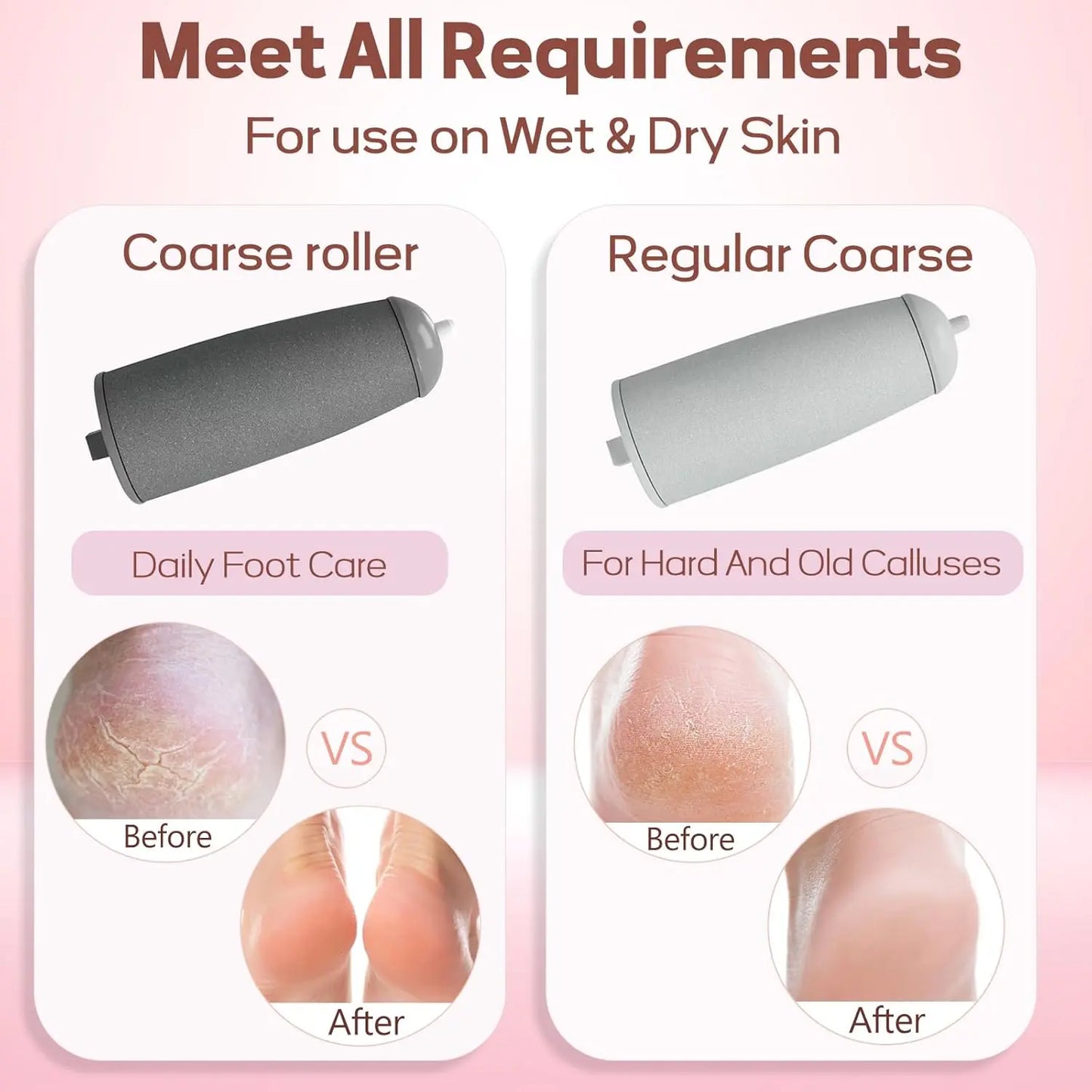 The #1 Electric Foot File for Salon-Smooth Feet in Minutes