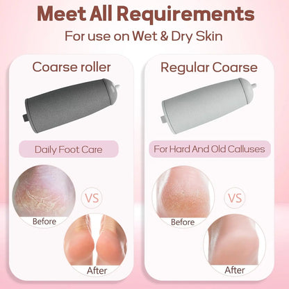 The #1 Electric Foot File for Salon-Smooth Feet in Minutes