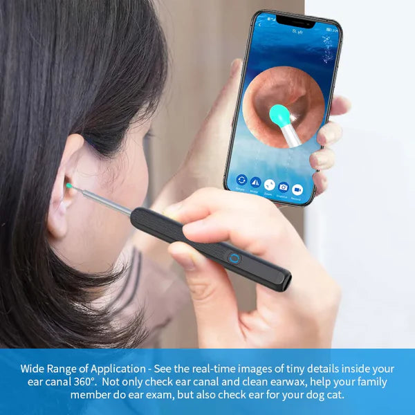 Smart Ear Cleaner with HD Camera – Safe Wireless Earwax Removal Tool for Adults & Kids