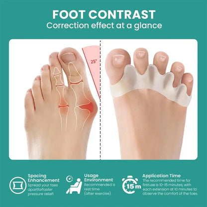 Silicone Toe Separator – Bunion & Hammer Toe Corrector (1 Pair)