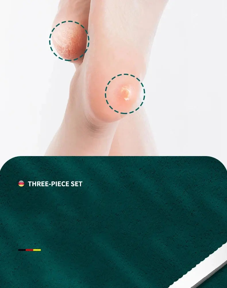 3-Piece Pedicure Knife Set – Professional Ingrown Toenail & Foot Care Kit