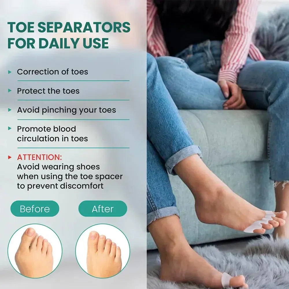 Silicone Toe Separator – Bunion & Hammer Toe Corrector (1 Pair)