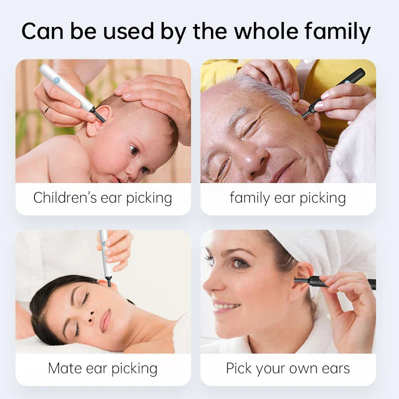 Smart Ear Cleaner with HD Camera – Safe Wireless Earwax Removal Tool for Adults & Kids